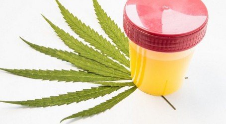 קנאביס בשתן – כיצד להיערך לקראת בדיקת שתן? המדריך המלא